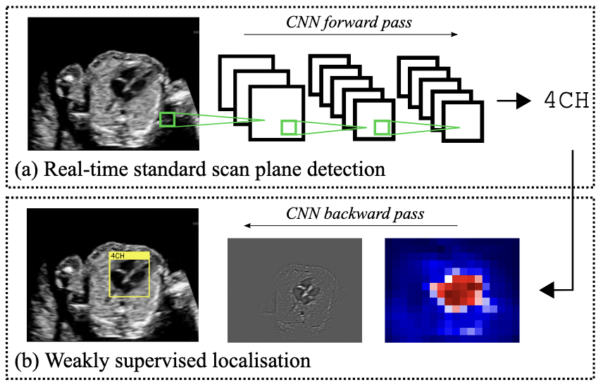 SonoNet: Real-Time Detection and Localisation of Fetal Standard Scan Planes in Freehand Ultrasound